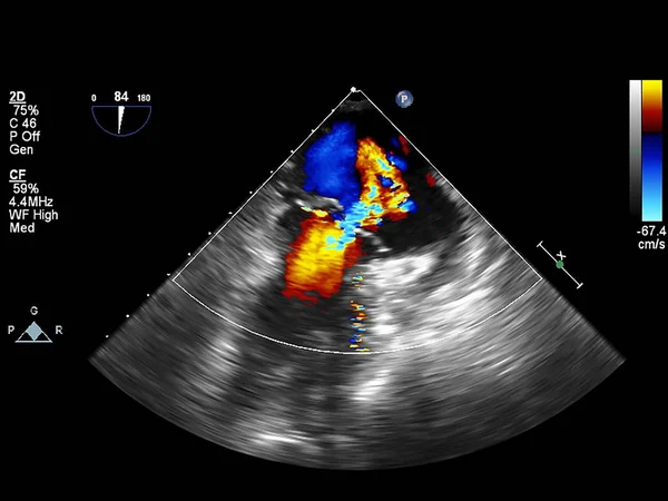 Screen of echocardiography (ultrasound) machine. — Stock Photo, Image