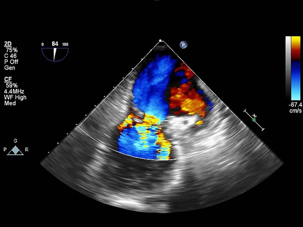 Tela da máquina de ecocardiografia (ultra-som) . — Fotografia de Stock