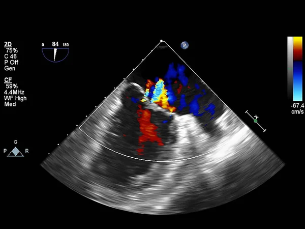 Pantalla de la máquina de ecocardiografía (ultrasonido) . —  Fotos de Stock