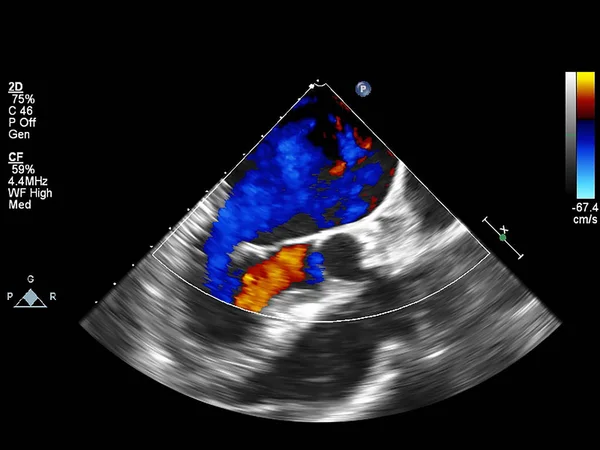 Pantalla de la máquina de ecocardiografía (ultrasonido) . — Foto de Stock