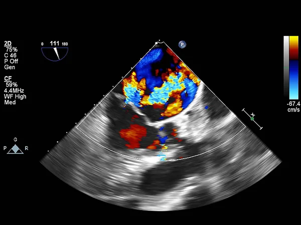 Écran de la machine d'échocardiographie (échographie) . — Photo