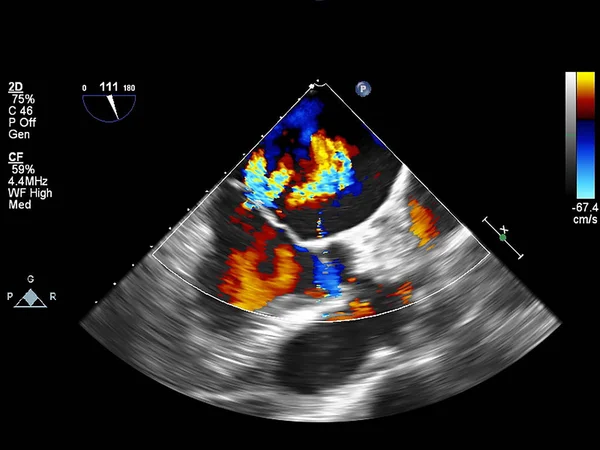 Scherm van echocardiografie (echografie) machine. — Stockfoto