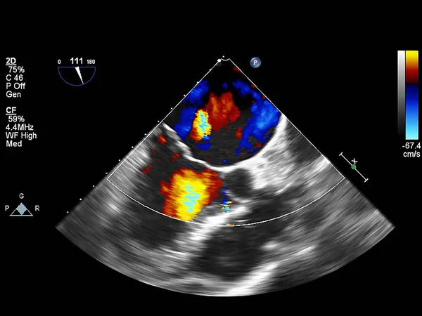 Screen of echocardiography (ultrasound) machine. — Stock Photo, Image