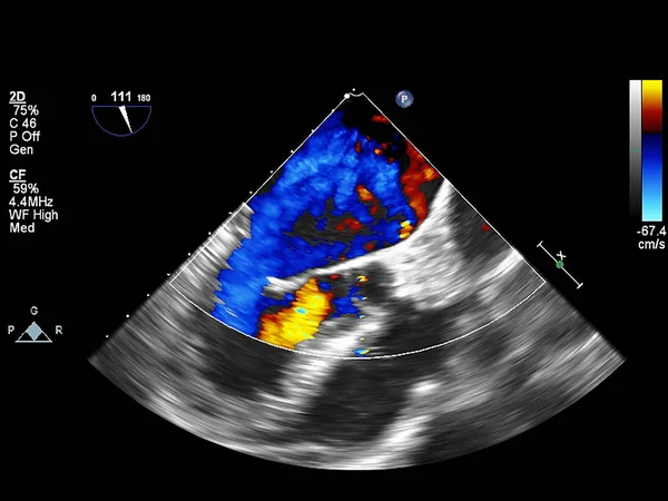 Tela da máquina de ecocardiografia (ultra-som) . — Fotografia de Stock