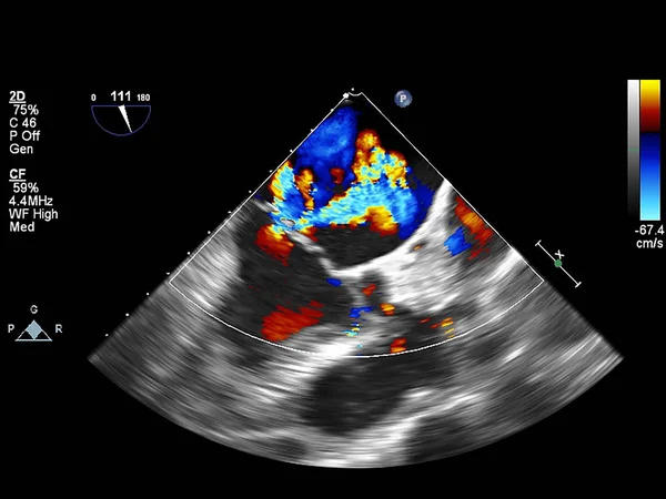 Pantalla de la máquina de ecocardiografía (ultrasonido) . — Foto de Stock