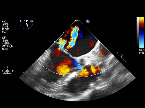 Scherm van echocardiografie (echografie) machine. — Stockfoto