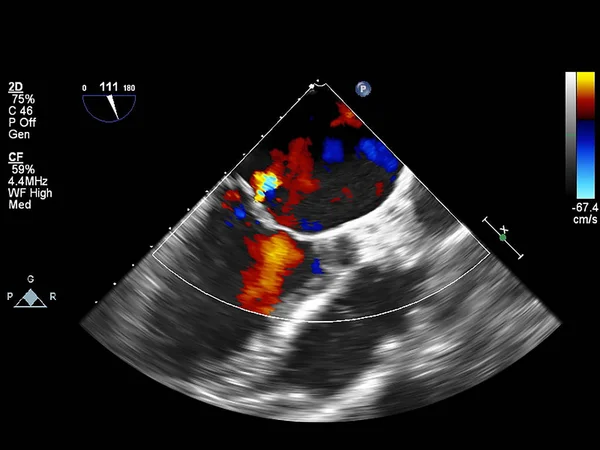 Écran de la machine d'échocardiographie (échographie) . — Photo