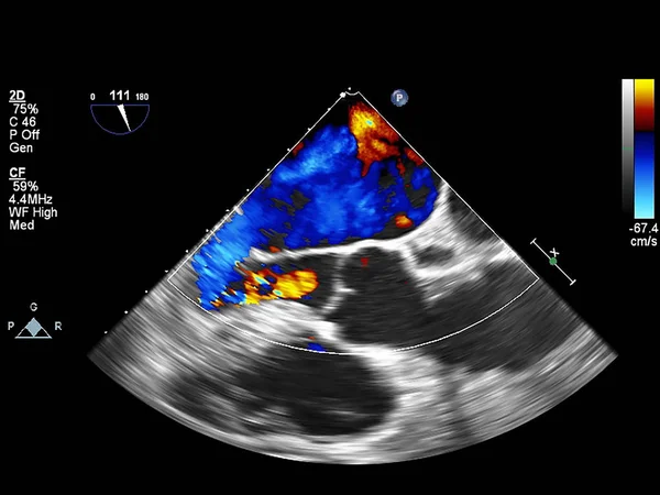 Écran de la machine d'échocardiographie (échographie) . — Photo