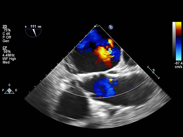 Pantalla de la máquina de ecocardiografía (ultrasonido) . —  Fotos de Stock