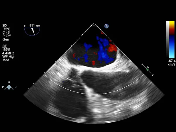 Écran de la machine d'échocardiographie (échographie) . — Photo