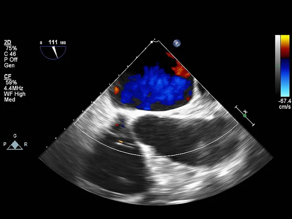 Ekran echokardiografii (USG) maszyny. — Zdjęcie stockowe