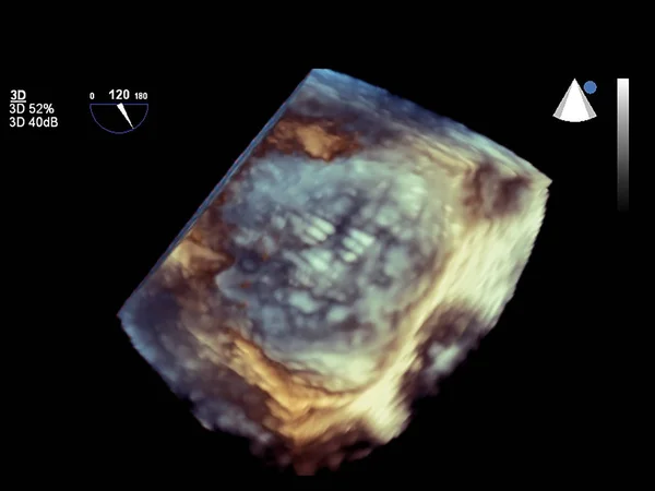 Nowoczesna Echokardiografia 3D. — Zdjęcie stockowe