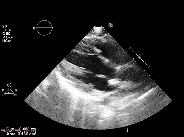 Écran de la machine d'échocardiographie (échographie) . — Photo