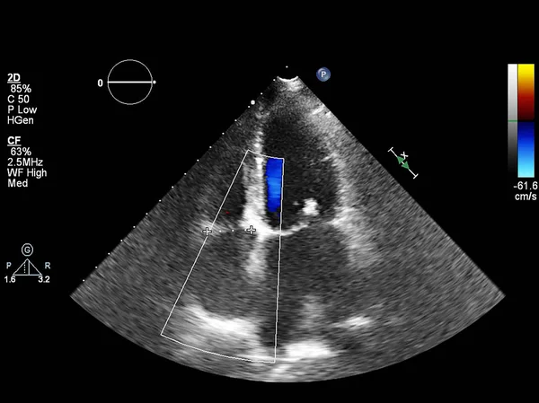 Bildschirm der Echokardiographie (Ultraschall) Maschine. — Stockfoto