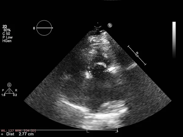 Écran de la machine d'échocardiographie (échographie) . — Photo