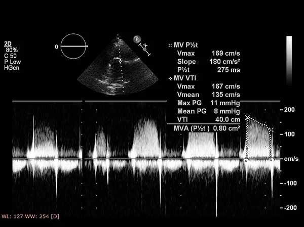 Scherm van echocardiografie (echografie) machine. — Stockfoto