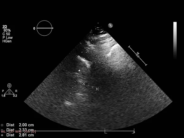 Écran de la machine d'échocardiographie (échographie) . — Photo