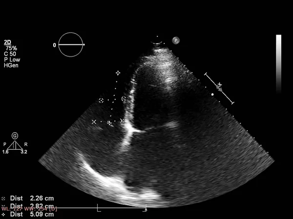 Écran de la machine d'échocardiographie (échographie) . — Photo