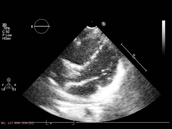 Écran de la machine d'échocardiographie (échographie) . — Photo