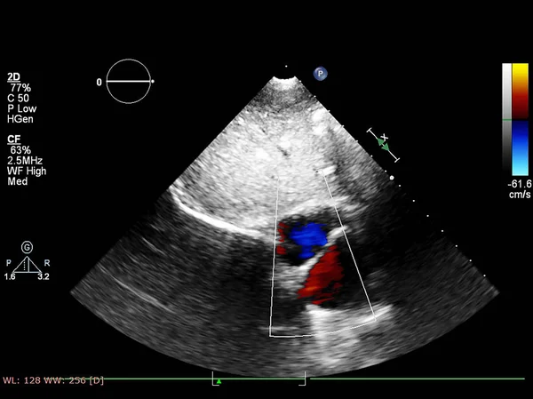 Ekran echokardiografii (USG) maszyny. — Zdjęcie stockowe