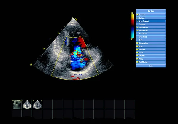 Scherm van echocardiografie (echografie) machine. — Stockfoto