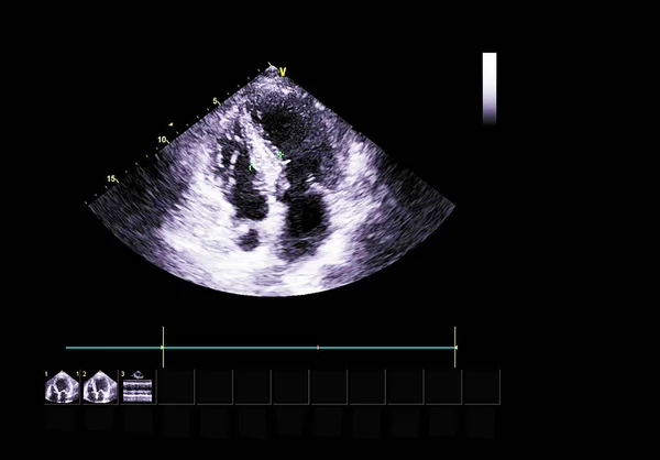 Tela da máquina de ecocardiografia (ultra-som) . — Fotografia de Stock