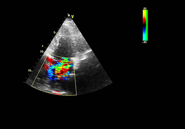 Écran de la machine d'échocardiographie (échographie) . — Photo