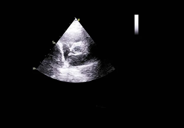 Tela da máquina de ecocardiografia (ultra-som) . — Fotografia de Stock