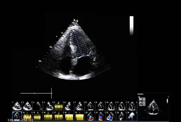 Scherm van echocardiografie (echografie) machine. — Stockfoto