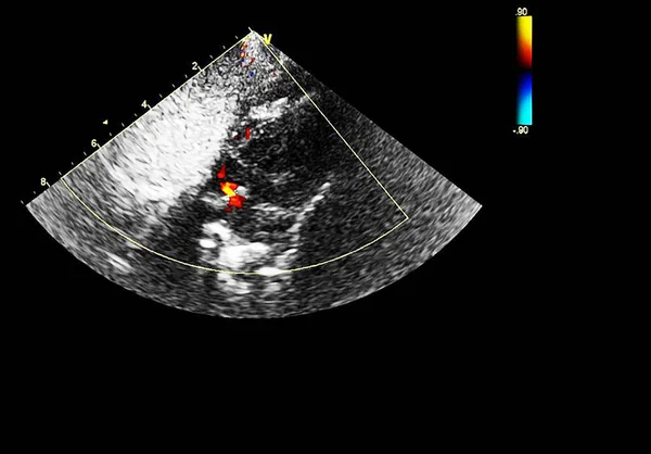 Ekokardiyografi (ultrason) makinesi nin ekranı. — Stok fotoğraf