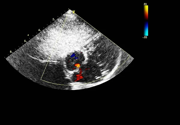 心エコー検査(超音波)マシンの画面. — ストック写真