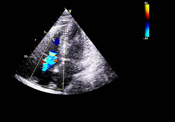 Pantalla de la máquina de ecocardiografía (ultrasonido) . — Foto de Stock