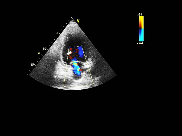 Tela da máquina de ecocardiografia (ultra-som) . — Fotografia de Stock