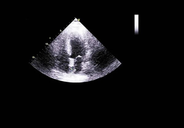 Ecran de ecocardiografie (ultrasunete) mașină . — Fotografie, imagine de stoc