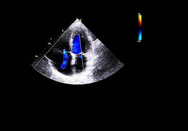 Ekran echokardiografii (USG) maszyny. — Zdjęcie stockowe