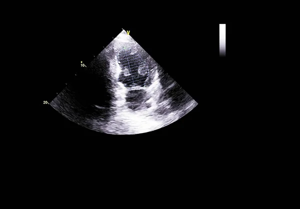 Tela da máquina de ecocardiografia (ultra-som) . — Fotografia de Stock