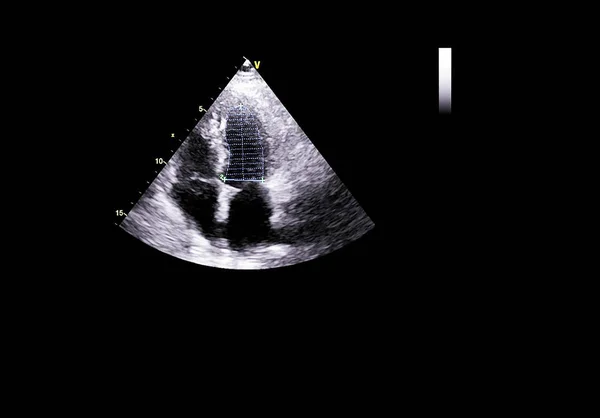 Écran de la machine d'échocardiographie (échographie) . — Photo