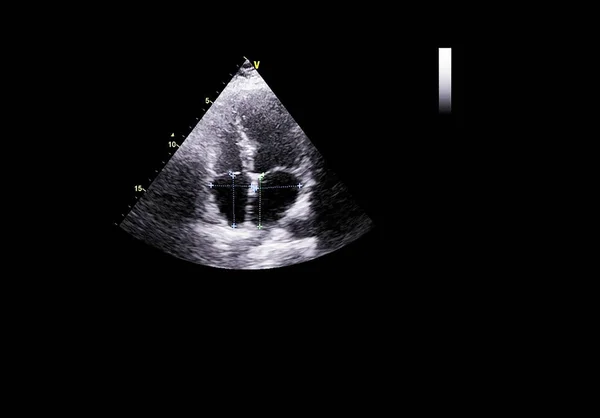 Tela da máquina de ecocardiografia (ultra-som) . — Fotografia de Stock