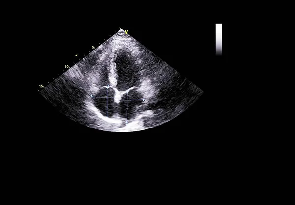 Tela da máquina de ecocardiografia (ultra-som) . — Fotografia de Stock