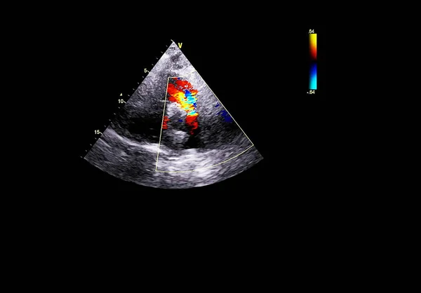 Ekran echokardiografii (USG) maszyny. — Zdjęcie stockowe