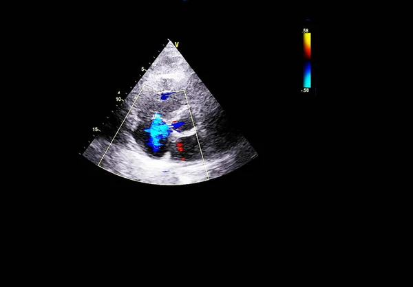 Tela da máquina de ecocardiografia (ultra-som) . — Fotografia de Stock