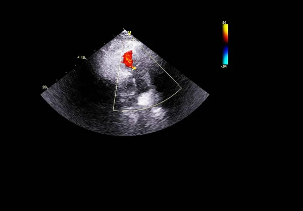 Tela da máquina de ecocardiografia (ultra-som) . — Fotografia de Stock