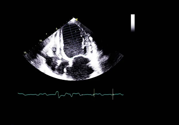 Scherm van echocardiografie (echografie) machine. — Stockfoto