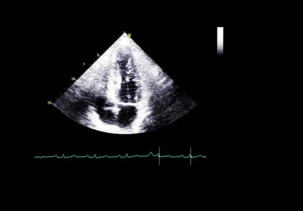 Écran de la machine d'échocardiographie (échographie) . — Photo