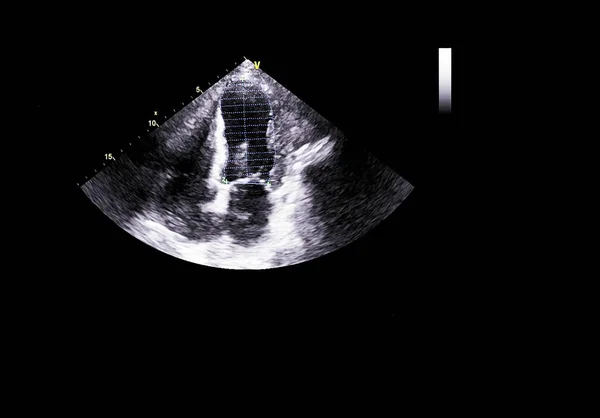 Scherm van echocardiografie (echografie) machine. — Stockfoto