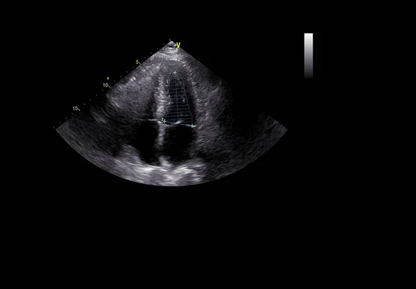 Tela da máquina de ecocardiografia (ultra-som) . — Fotografia de Stock