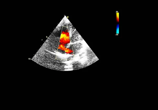 Οθόνη ηχοκαρδιογραφίας (υπερήχων) μηχανή. — Φωτογραφία Αρχείου