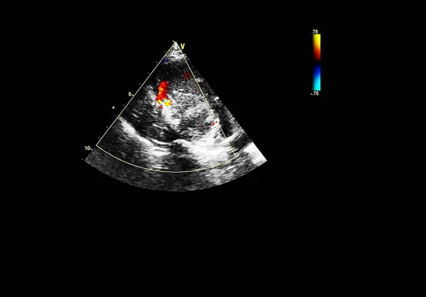 Οθόνη ηχοκαρδιογραφίας (υπερήχων) μηχανή. — Φωτογραφία Αρχείου