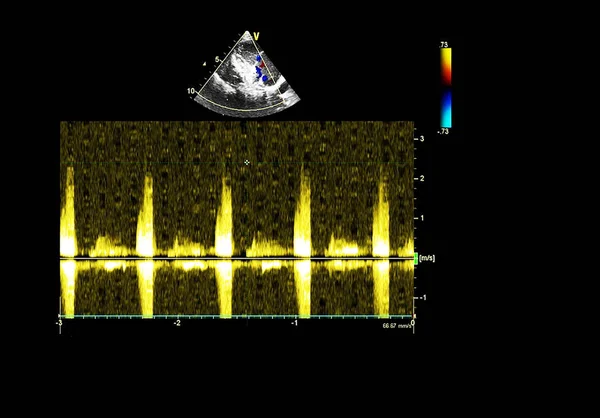 Bildschirm der Echokardiographie (Ultraschall) Maschine. — Stockfoto