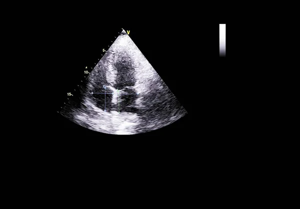 Écran de la machine d'échocardiographie (échographie) . — Photo